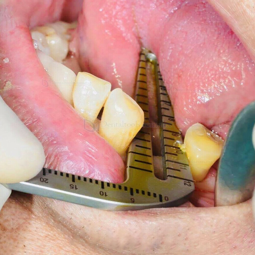 TT Localizador quir&uacute;rgico L y S para implantes con regla de medici&oacute;n